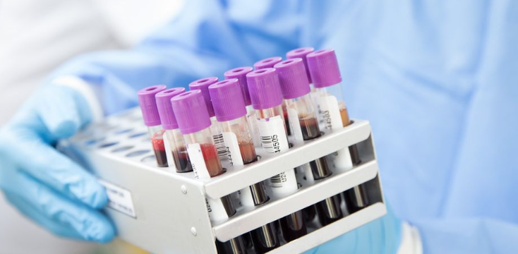 Dr. Ambreen Mohamed Doctor holding blood work